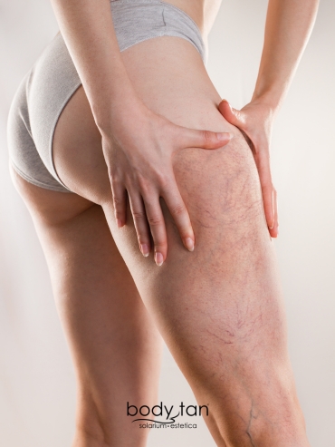 programma-legs-estika-bodytan-prod